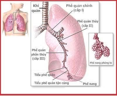 
Xẹp phổi là dấu hiệu lâm sàng cho thấy hit sặc chu phẫu
