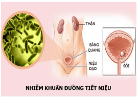 
Người bệnh nhiễm khuẩn đường tiết niệu nặng, chưa ổn định có chống chỉ định mổ cắt u niệu đạo
