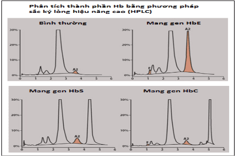 
Phân tích thành phần Hb bằng phương pháp sắc ký lỏng hiệu nâng cao
