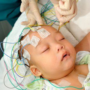 Có thể đo điện não cho bé vào ban đêm được không?