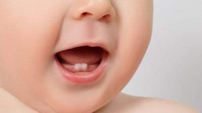 Bé 14 tháng tuổi mọc được hai răng liệu có phải chậm mọc răng?