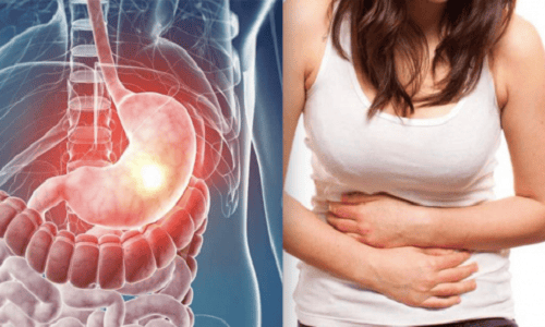 Gastroesophageal reflux disease - can I take vitamin 3B?