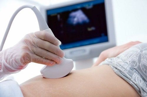 Fetal color ultrasound and what mothers should note