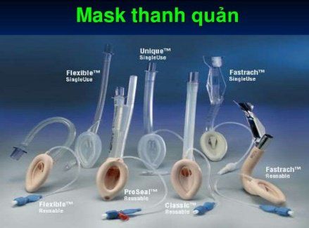 
Sử dụng mặt nạ thanh quản để thông đường thở cho bệnh nhân
