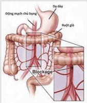 Digital background erasing mesenteric angiography