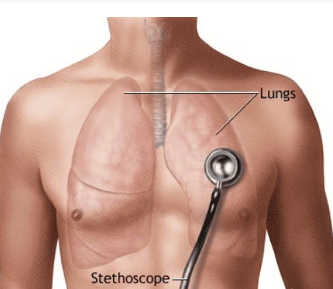 
Ống nghe phổi giúp chẩn đoán bệnh hen phế quản
