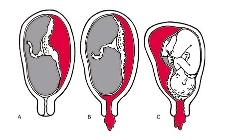 What is the test of peeling vegetables, supporting vegetables, checking the placenta to do?