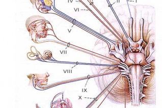 
Biểu hiện lâm sàng của bệnh là các dấu hiệu thần kinh khu trú
