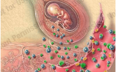 Hellp syndrome in obstetrics