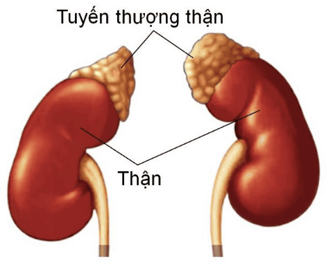 
Bệnh nhân u tuyến thượng thận được chỉ định chụp cộng hưởng từ ổ bụng không tiêm thuốc đối quang từ
