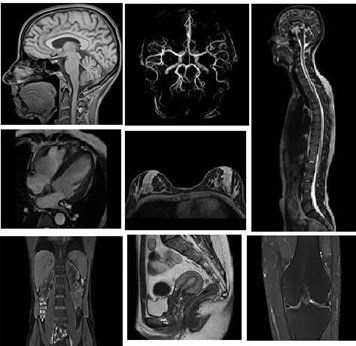 Intravenous magnetic resonance imaging procedure with injection of magnetic contrast agent