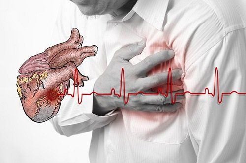 Cục máu đông là nguyên nhân gây nên những cơn đau tim