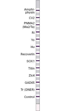 
Xét nghiệm EUROLINE Paraneoplastic Neurologic Syndrome 12 Ag (IgG)
