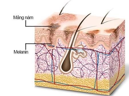 
Melanin là sắc tố tạo màu da, tóc và mắt cho mỗi người
