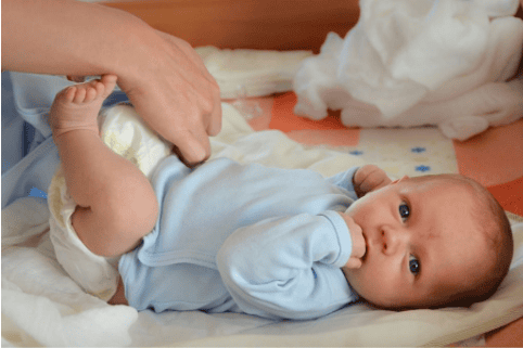 
Congenital hip dislocation often occurs in premature babies
