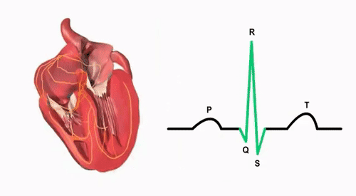 What is sinus arrhythmia? Causes and treatments