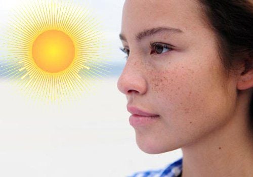 Direct exposure to sunlight is the most common cause of hyperpigmentation