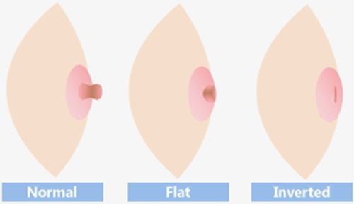 During puberty, girls may experience inverted nipples.