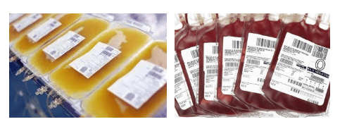 Unexpected complications related to blood transfusion