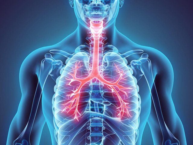 Lung cancer risk factors | Vinmec