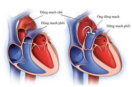 Your Arterial Life Cycle | Vinmec