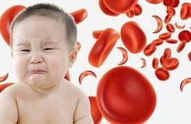 Trẻ 18 tháng tuổi xét nghiệm máu bị thiếu máu và hồng cầu nhỏ có phải do thiếu sắt hay không?