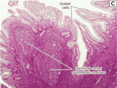 
Hình 5. Cấu trúc mô học của ruột non (Goblet cells)
