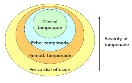 What is acute tamponade? Signs of recognition and treatment