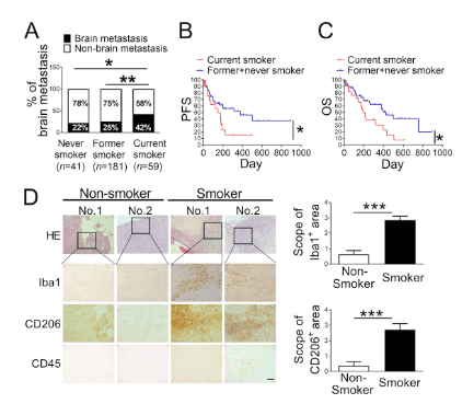 
Fig.1. Cigarette smoking increases incidence and mortality rate of lung cancer brain metastasis.
