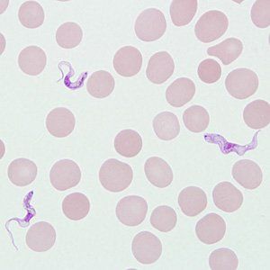 
Ký sinh trùng Trypanosoma gambiense gây ra bệnh ngủ, chúng kí sinh trong nhiều tế bào
