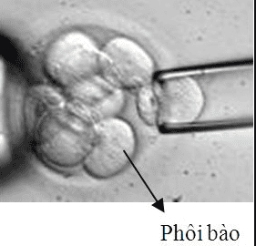 Sinh thiết phôi trong chẩn đoán di truyền tiền làm tổ