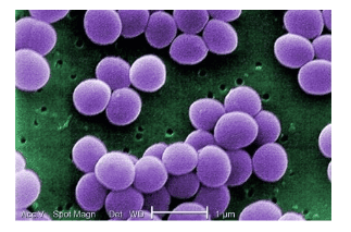 
Hình ảnh tụ cầu vàng (Staphylococcus aureus)
