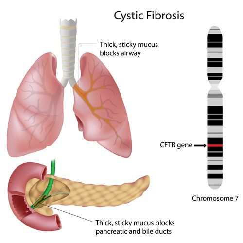 What imaging techniques are used to diagnose cystic fibrosis?