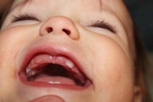 17-month-old children: Nutrition and oral care