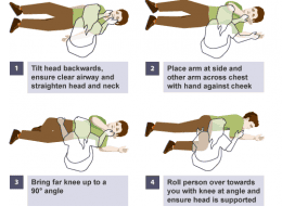 Basic life support and circulatory arrest