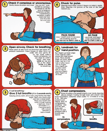 Basic life support and circulatory arrest