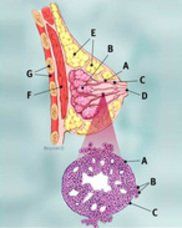 
Hình ảnh carcinoma ống tuyến xâm lấn
