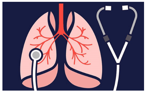 
Bệnh phổi tắc nghẽn mạn tính là một trong những nguyên nhân chính dẫn đến tâm phế mạn
