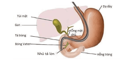 
Hình minh họa tương quan giữa các cấu trúc đường mật. Hỗng tràng là đoạn ruột non kế tiếp tá tràng.
