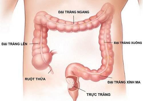 
Hình 1: Khung đại tràng, nơi thường xảy ra các rối loại về đi tiêu
