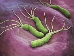 
Các thể bệnh viêm loét dạ dày chủ yếu vẫn nhiễm Helicobacter pylori
