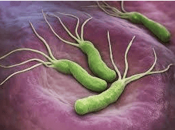 H.pylori infection is associated with B12 deficiency and iron deficiency anemia