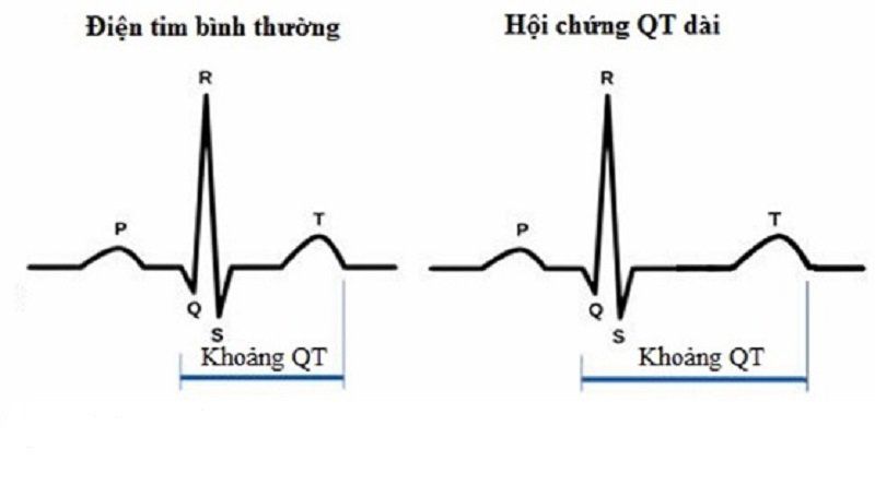 7. Phòng ngừa hội chứng QT dài