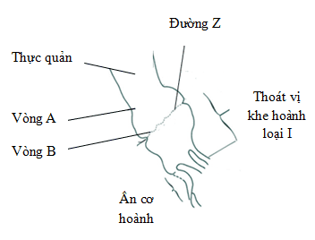 
Hình 5: Sơ đồ minh họa vòng A và đường Z (Nguồn: . Peter J. Kahrilas (2008))
