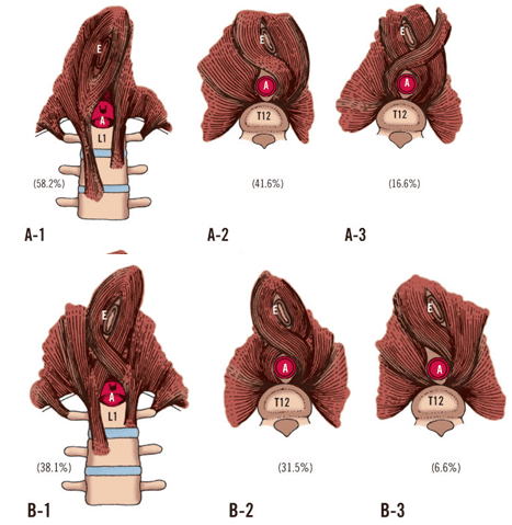 
Hình 4: Các dạng phổ biến nhất của trụ cơ hoành (Nguồn: Skandalakis LJ. (2006))
