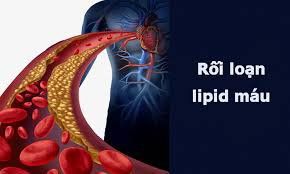 Principles of treatment of dyslipidemia