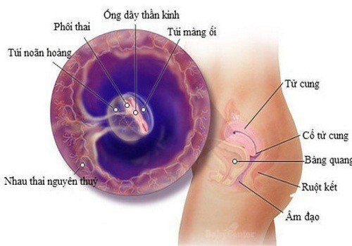 
Thể tế bào mầm có thể tạo nên U túi noãn hoàng
