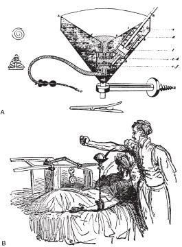 
: Bác sĩ Richard Lower phát minh ra dụng cụ truyền máu (1665)
