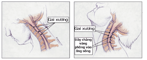 
Cơ chế động của cột sống cổ
