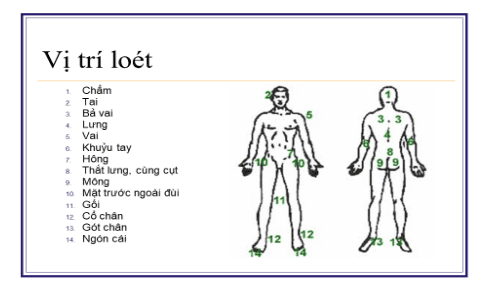 Loét do tỳ đè ở những bệnh nhân phải nằm bất động lâu ngày